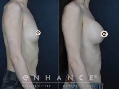 Before and afters - 181