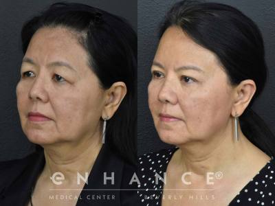 Before and afters - 201