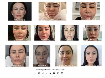 Before and afters - 217