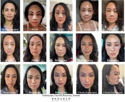 Before and afters - 216