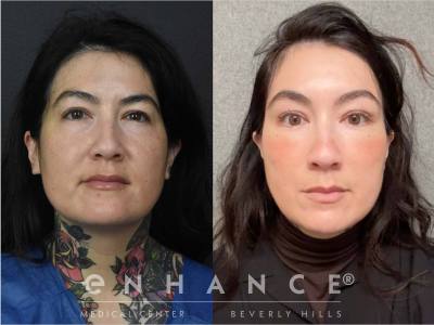 Before and afters - 221