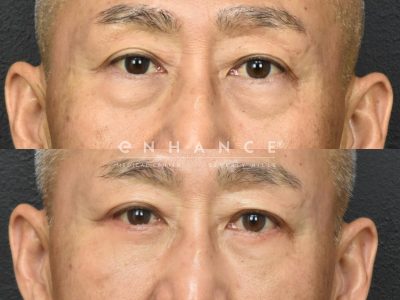 Before and afters - 235