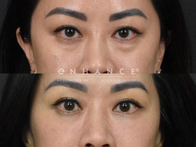 Before and afters - 236