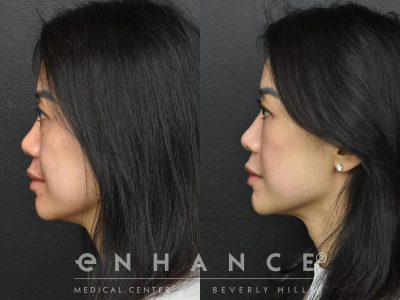 Before and afters - 237