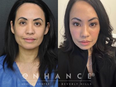 Before and afters - 211