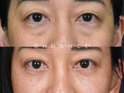 Before and afters - 189