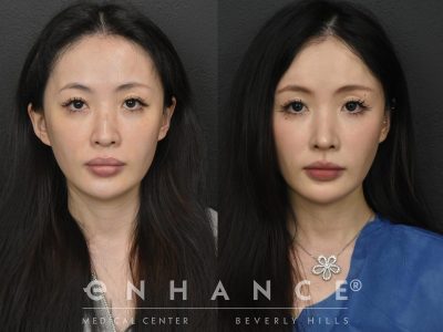 Before and afters - 231