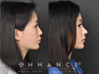 Before and afters - 232