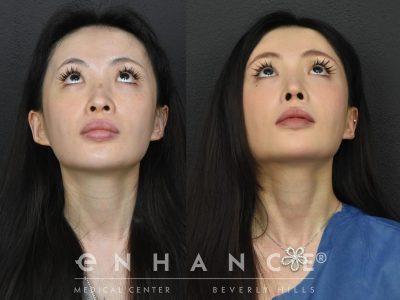 Before and afters - 233