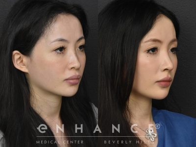 Before and afters - 234