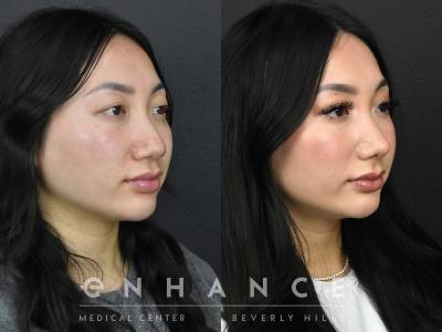 Before and afters - 208
