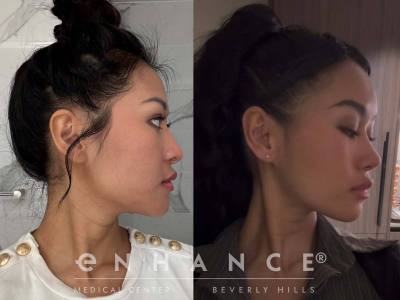 Before and afters - 183