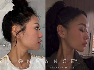 Before and afters - 183