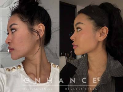 Before and afters - 184