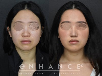 Before and afters - 270