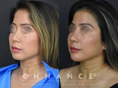 Before and afters - 163
