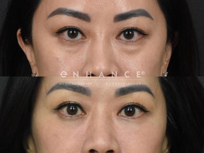 Before and afters - 236