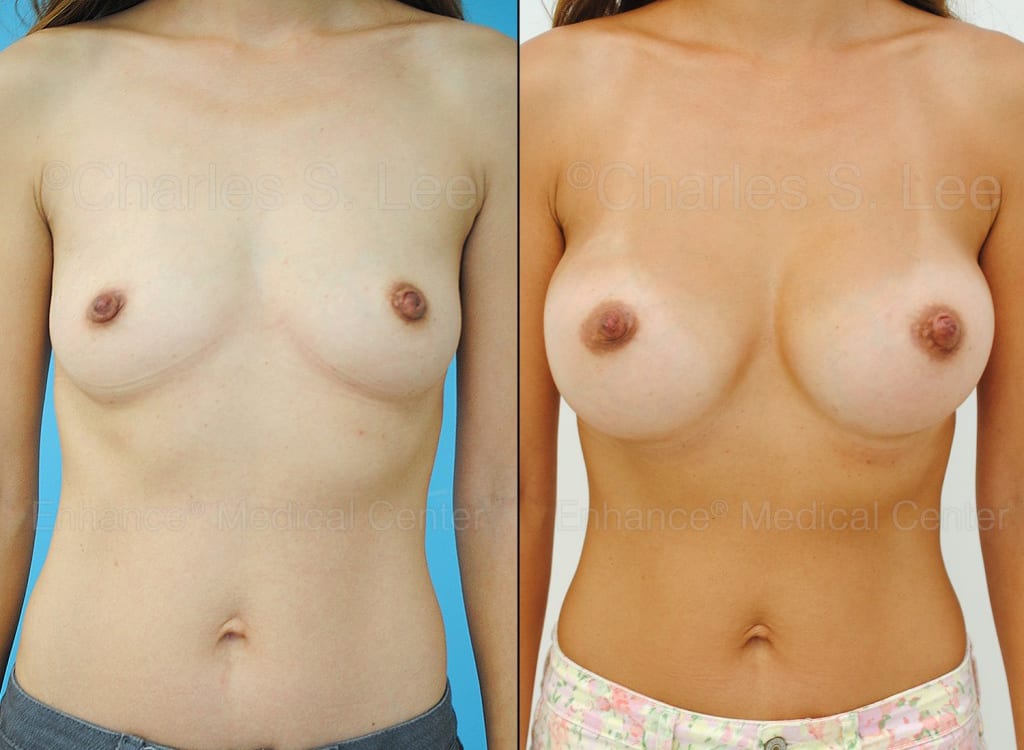 asian cosmetic plastic surgery