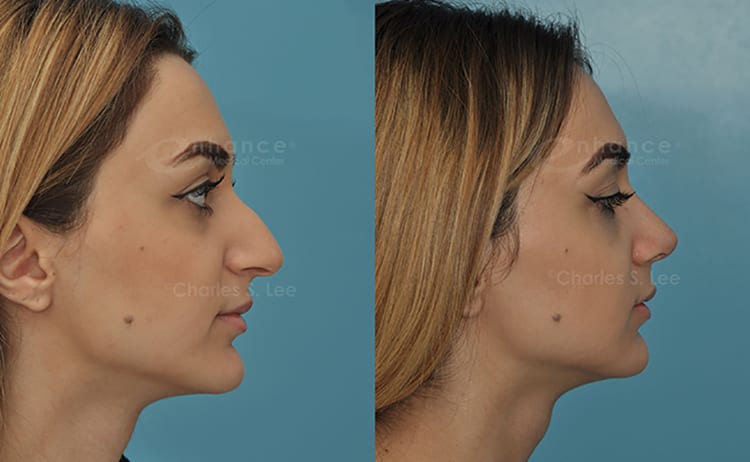 Gay golden showers groups